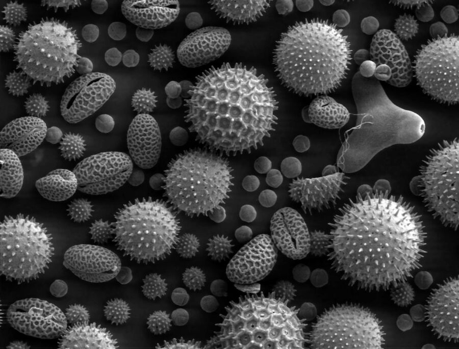 Pollen von verschiedenen Pflanzenarten, Elektronenmikroskopische Aufnahme